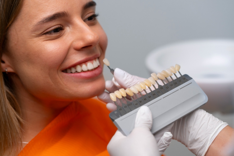 What Is Composite Bonding?